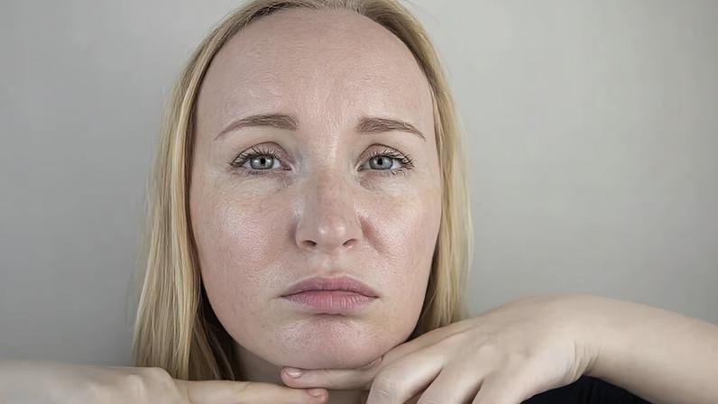 Rosto sequinho: estratégias para reduzir a oleosidade de forma saudável