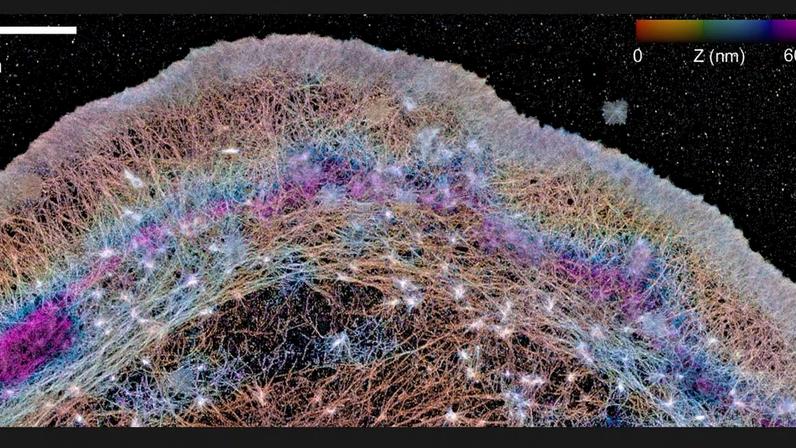 Actina em 3D revela “barreiras” e fluxos dentro da célula. (Imagem adaptada: Catherine G. Galbraith via Nature Communications)