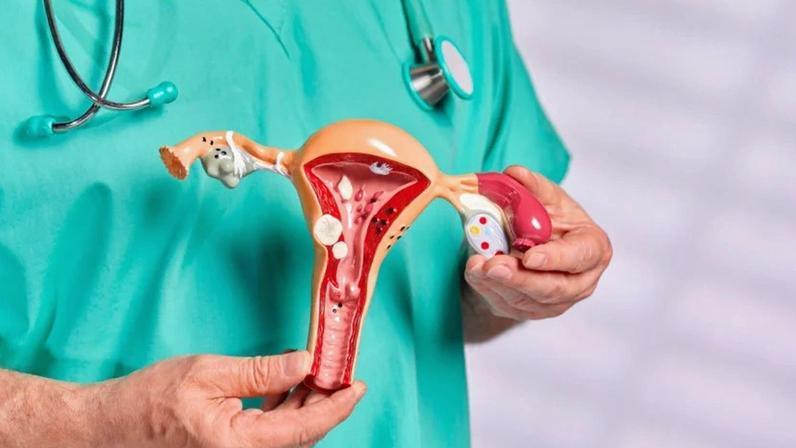Tratamento do câncer de ovário avança com integração entre cirurgia e medicação