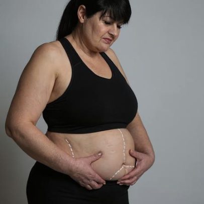 Ciência reavalia mito do metabolismo lento com evidências