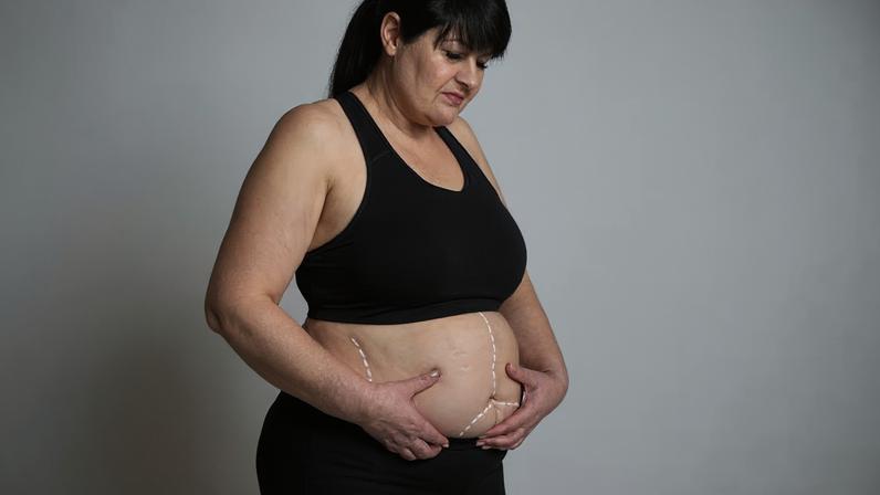 Ciência reavalia mito do metabolismo lento com evidências