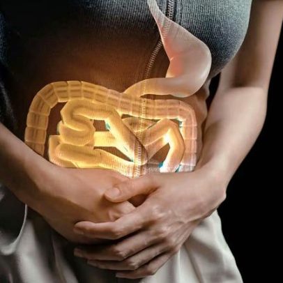 Alterações no intestino podem indicar câncer antes do diagnóstico