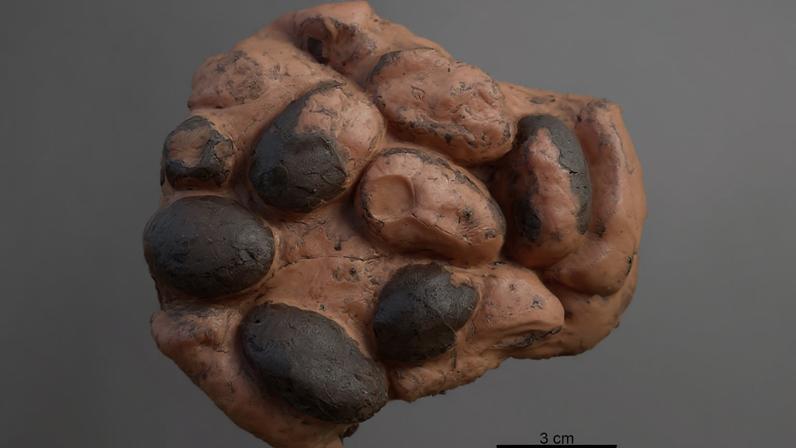 Holótipo de Suchoolithus portucalensis, do Jurássico Superior, indica ninhada preservada ainda não eclodida (Imagem: Russo J, Mateus O, Marzola M, Balbino A (2017) PLoS ONE)