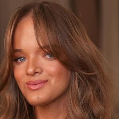 Rafaella Justus faz rinoplastia e revela resultado