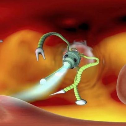 Nanorrobôs entregam remédios com precisão cirúrgica no câncer