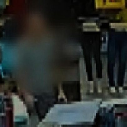Homem baleado na cabeça em SP sobrevive; osso frontal espesso salvou, diz filha