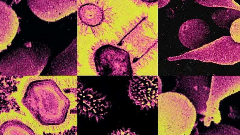 Colagem feita com imagens microscópicas de diversos tipos de vírus.