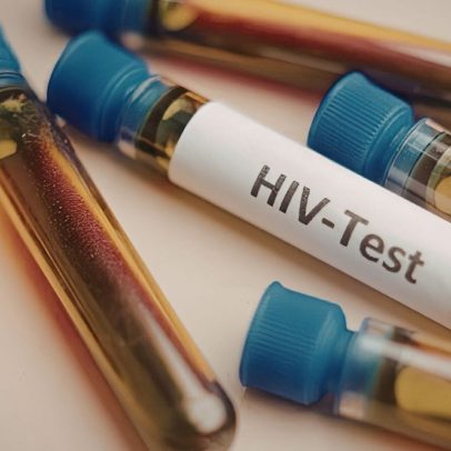 Transplante de medula de irmão leva homem à remissão do HIV, mostra estudo