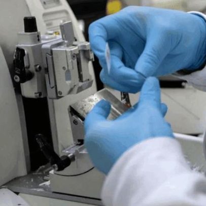 Nova lei amplia acesso a terapias e vacinas contra o câncer pelo SUS
