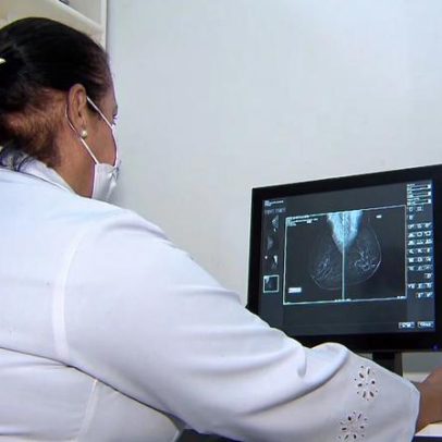 Lei não define como comprovar exames preventivos, diz advogado