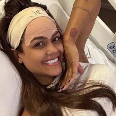Camila Loures passa por cirurgia na testa e divide opiniões