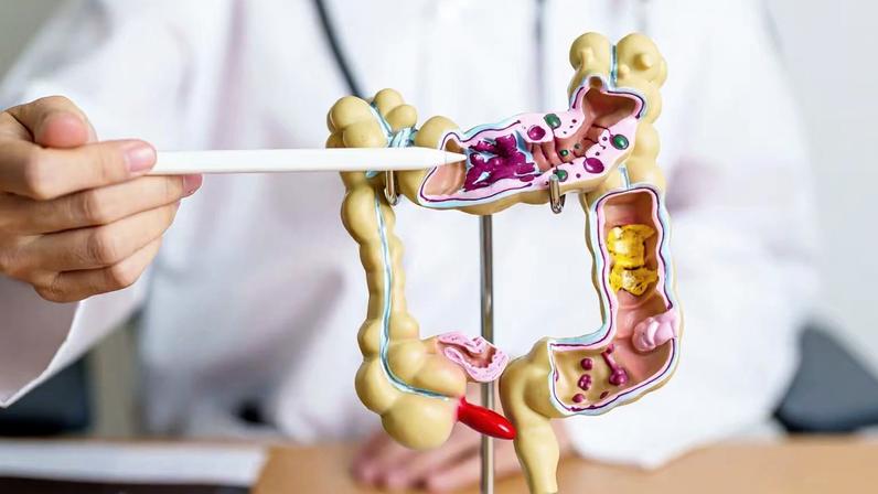 Microbioma pode afetar tratamento do câncer. (Foto: Getty Images via Canva)
