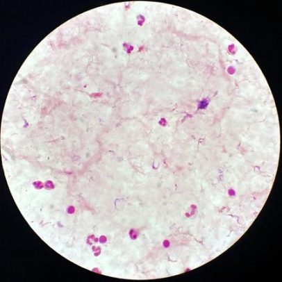 Parasita perigoso ativa triturador para enganar o sistema imune humano