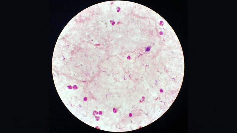 Parasita perigoso ativa triturador para enganar o sistema imune humano