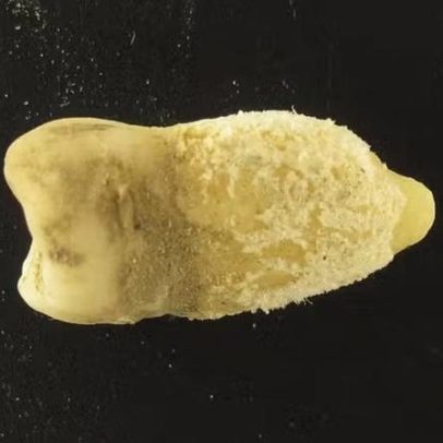 Múmia de 700 anos encontrada na Bolívia carrega bactéria da dor de garganta