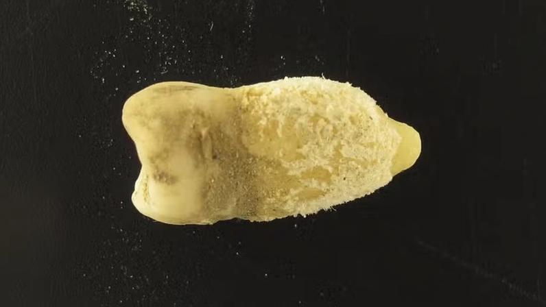 Este dente pertencia a um jovem que viveu no Altiplano boliviano há cerca de 700 anos. A equipe de pesquisa detectou nele a bactéria da escarlatina, Streptococcus pyogenes — Foto: Eurac Research/Guido Valverde