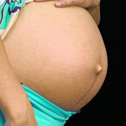 BH reforça vacinação de gestantes para proteger bebês contra bronquiolite sazonal