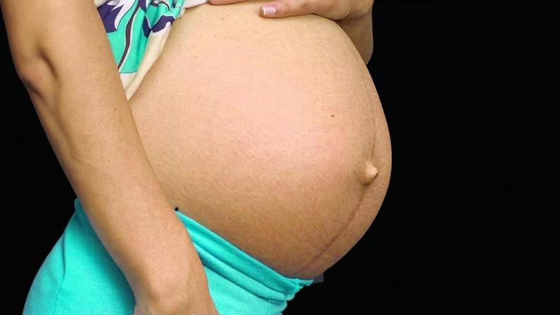 A vacina é indicada para gestantes a partir da 28ª semana de gestação