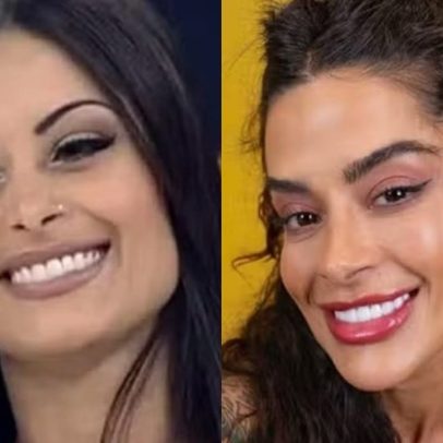 Mudanças no visual dos ex-BBBs vão de minilifting a novo sorriso