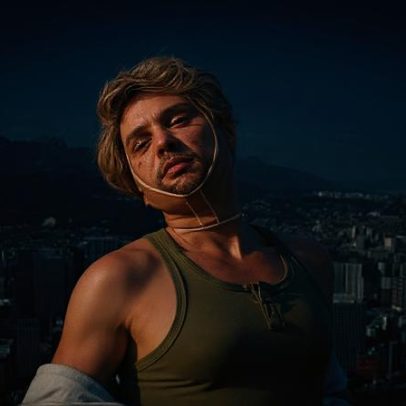 Ex-participante finlandês do Big Brother fica cego após lifting facial