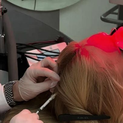 Virginia Fonseca revela retorno da alopecia areata e gatilhos