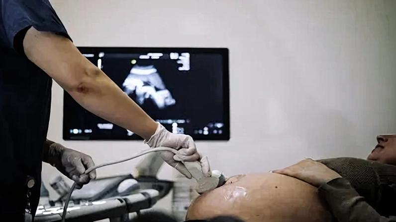 Estudo mostra importância do pré-natal para evitar anomalias congênitas