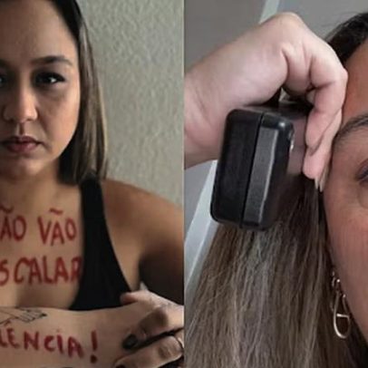 Advogada diz ter acionado botão do pânico 50 vezes contra ex-violento; foi atendida uma vez