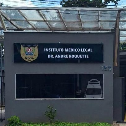 Padrasto e mãe de menino com sinais de violência são presos no IML