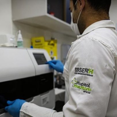 Ebserh contrata banca para editais de temporários após concurso