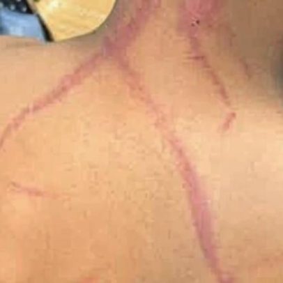 Pastores são presos no RJ suspeitos de torturar criança de 9 anos
