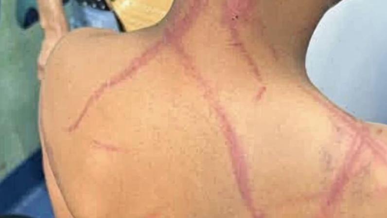 Criança de 9 anos é torturada por casal, no Rio de Janeiro