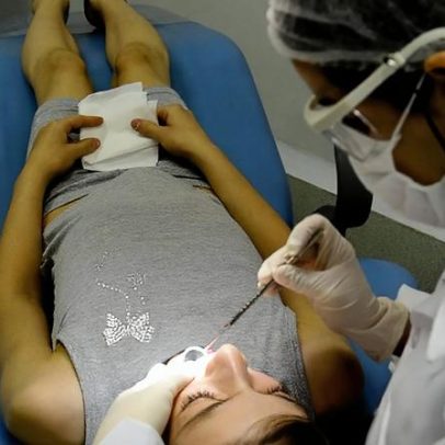 Programa seleciona jovens para tratamento odontológico gratuito