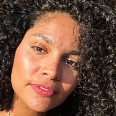 Bárbara Reis fará cirurgia para tratar lipedema, doença inflamatória