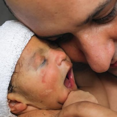 Exposição de fotografia em BH retrata cuidado neonatal em imagens sensíveis