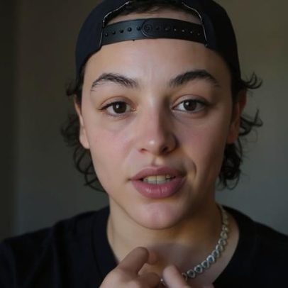 Pabllo Vittar critica ficante que vazou fotos após a terceira rinoplastia