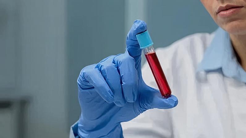 Exame de sangue pode ajudar a detectar hanseníase mais cedo
