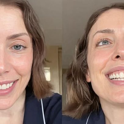 Fabiana Justus comemora dois anos de recuperação após transplante de medula
