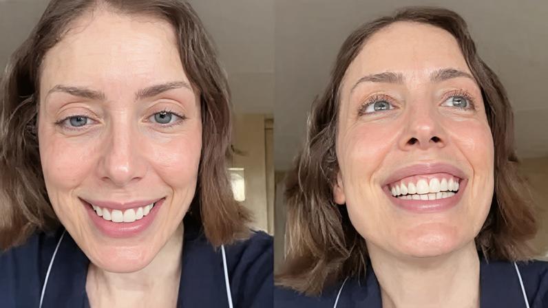 Fabiana Justus fala sobre renascimento 2 anos após pega de medula