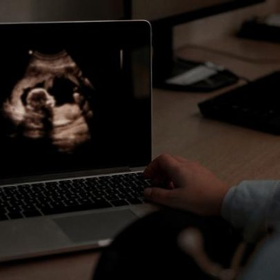Tratamentos de fertilidade vão além da solução rápida