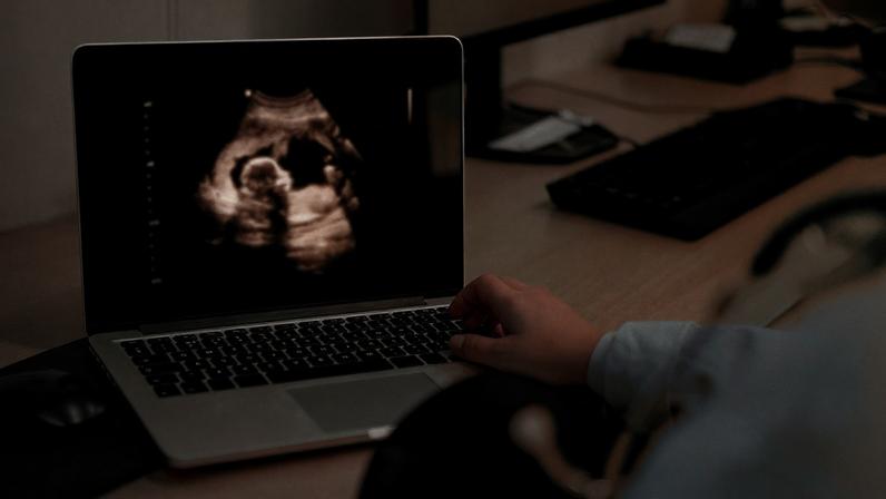 A doctor reviewing an ultrasound.