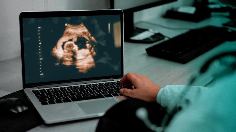 A doctor reviewing an ultrasound.