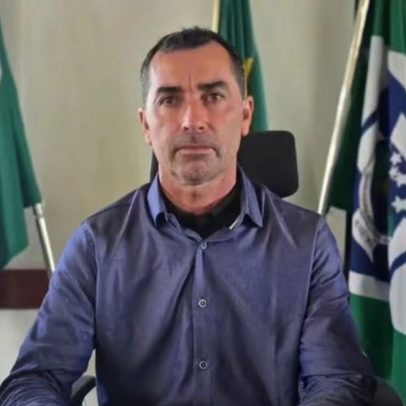 Vereador fica com 75% do corpo queimado após ataque em loja no PR