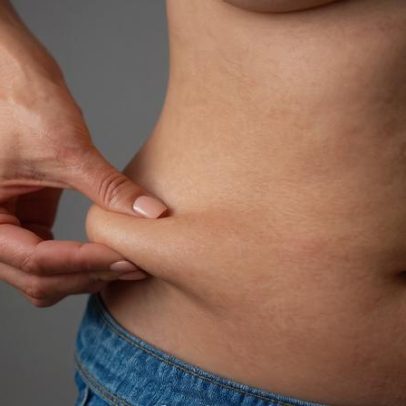 Nutrólogo apresenta 5 estratégias eficazes para reduzir gordura visceral