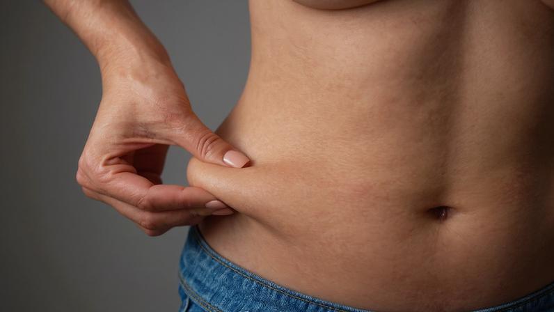 Foto colorida de mulher pegando na gordura localizada na barriga - Nutricionista explica o que é gordura visceral e por que é perigosa - Metrópoles