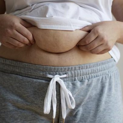 Gordura abdominal: 3 grupos de alimentos e 2 hábitos a evitar