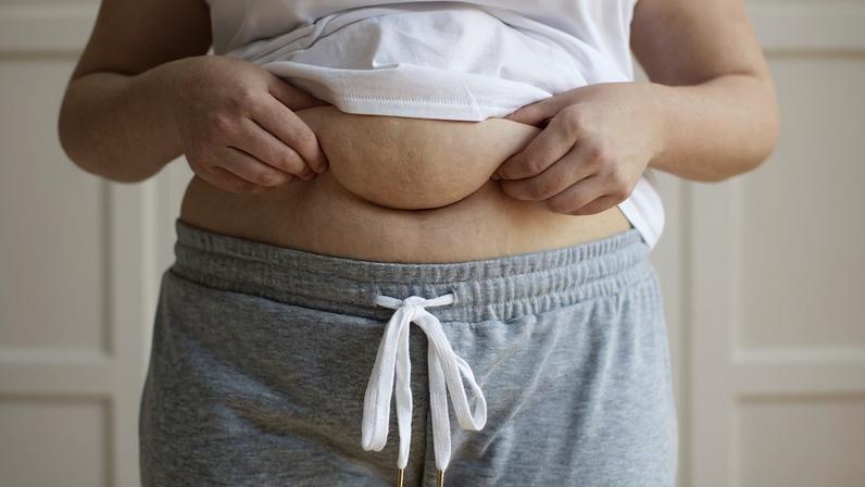 Foto colorida de crpor feminina evidenciando a gordura abdominal - Metrópoles.