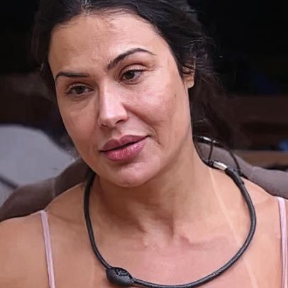 Gracyanne Barbosa retira preenchimentos faciais; confira antes e depois