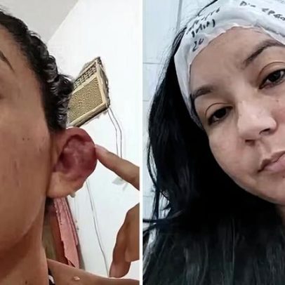 Gestante perde bebê após colocar piercing no Pará