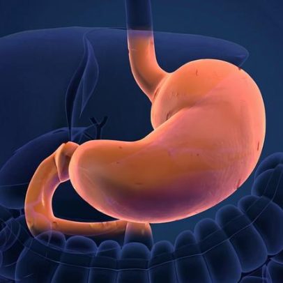 Gastroenterologista explica se a infecção por H. pylori é curável