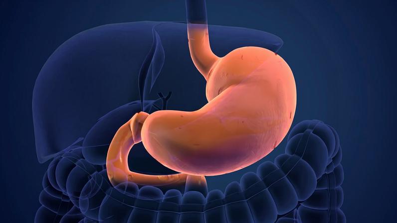Ilustração colorida de estômago com H. pylori - Metrópoles